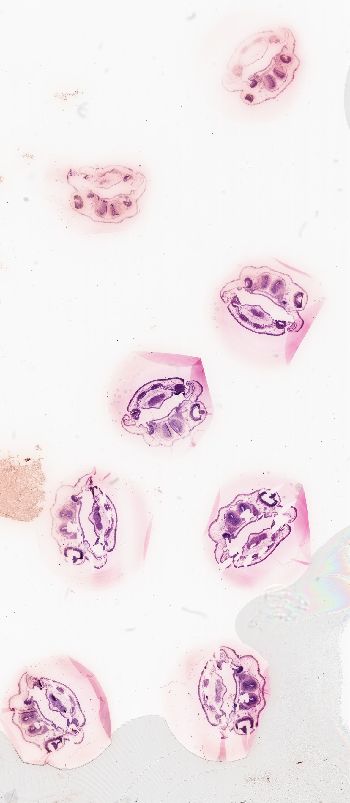 Media type: image; Special Collections 3992   shows specimen_part histological serial section;